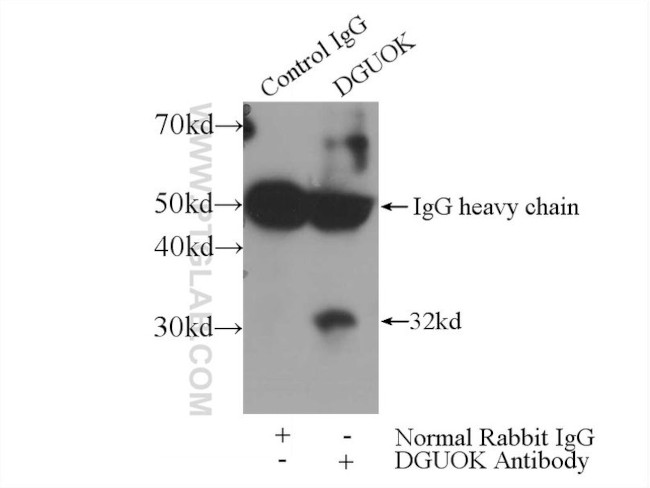 dGK Antibody in Immunoprecipitation (IP)