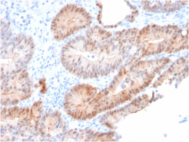 Aldo-keto Reductase Family 1 Member C2/DD2 Antibody in Immunohistochemistry (Paraffin) (IHC (P))