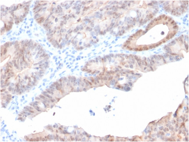 Aldo-keto Reductase Family 1 Member C2/DD2 Antibody in Immunohistochemistry (Paraffin) (IHC (P))