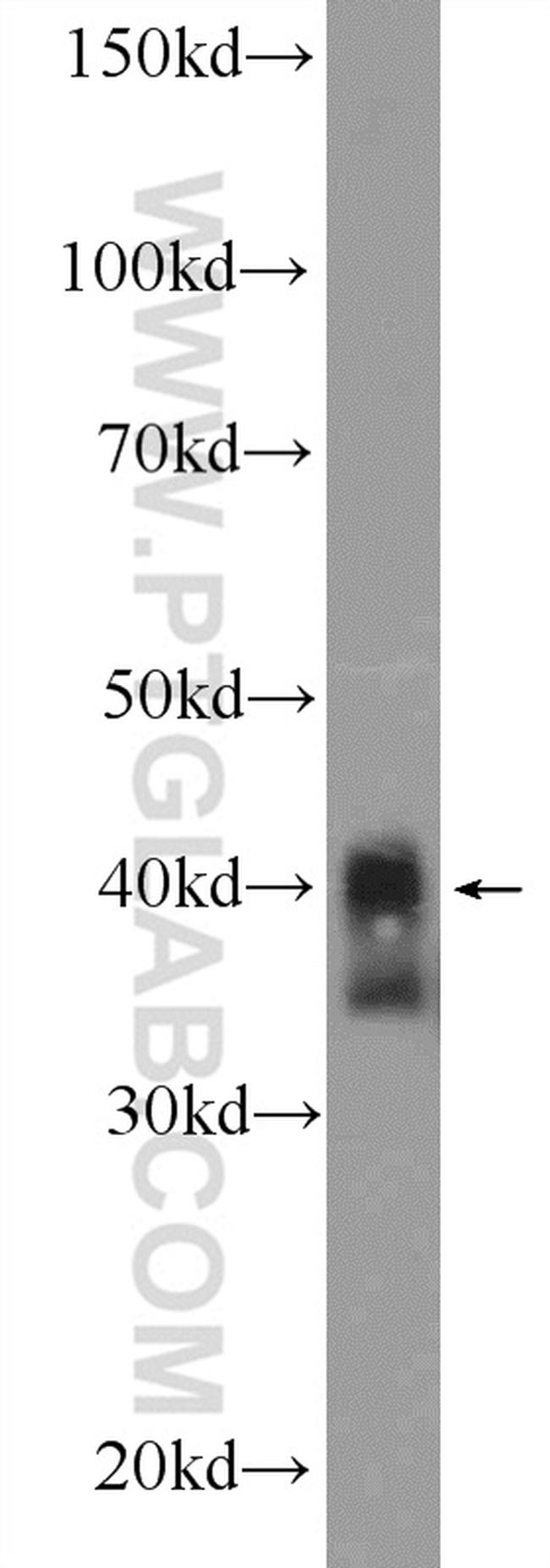 XPA Antibody in Western Blot (WB)