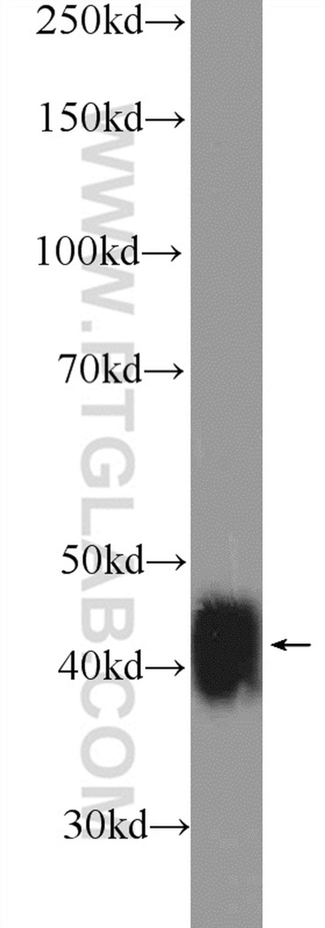 XPA Antibody in Western Blot (WB)