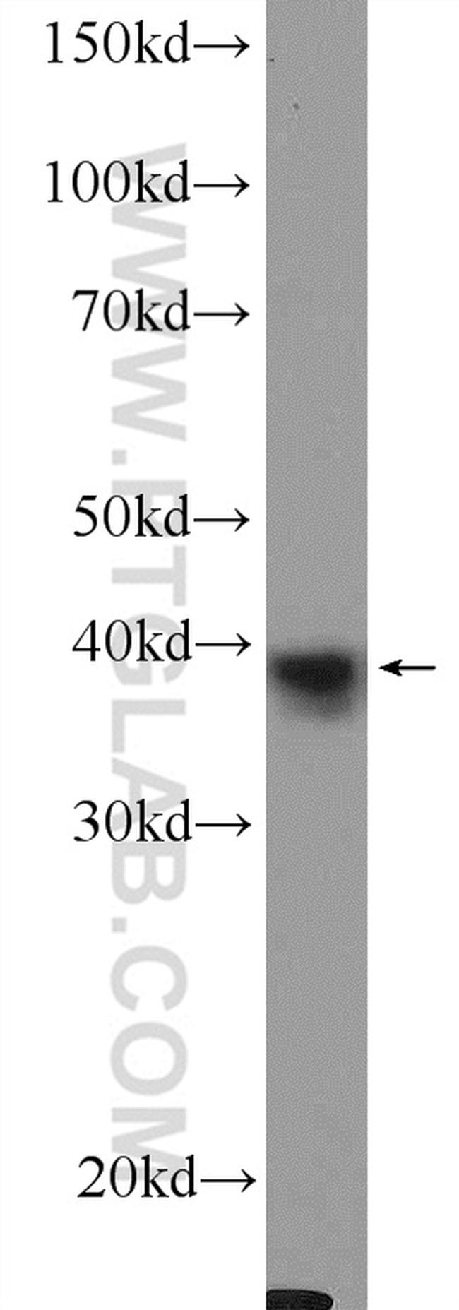 XPA Antibody in Western Blot (WB)