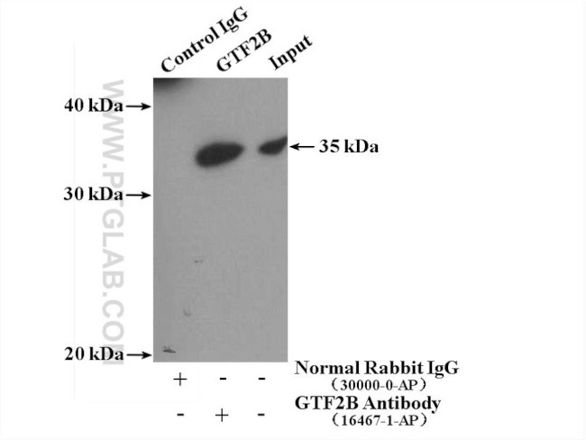 GTF2B Antibody in Immunoprecipitation (IP)