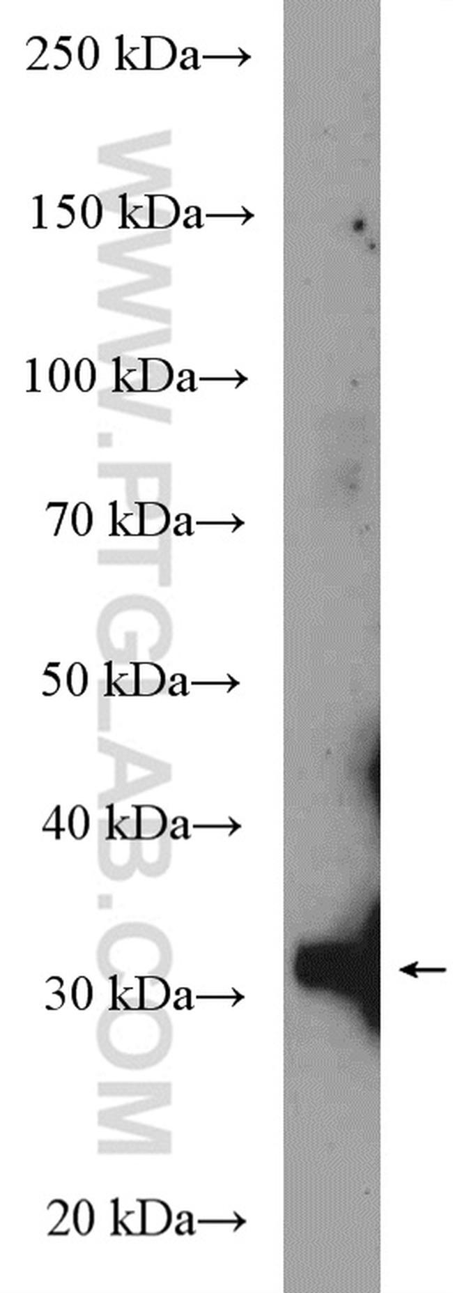 GTF2B Antibody in Western Blot (WB)