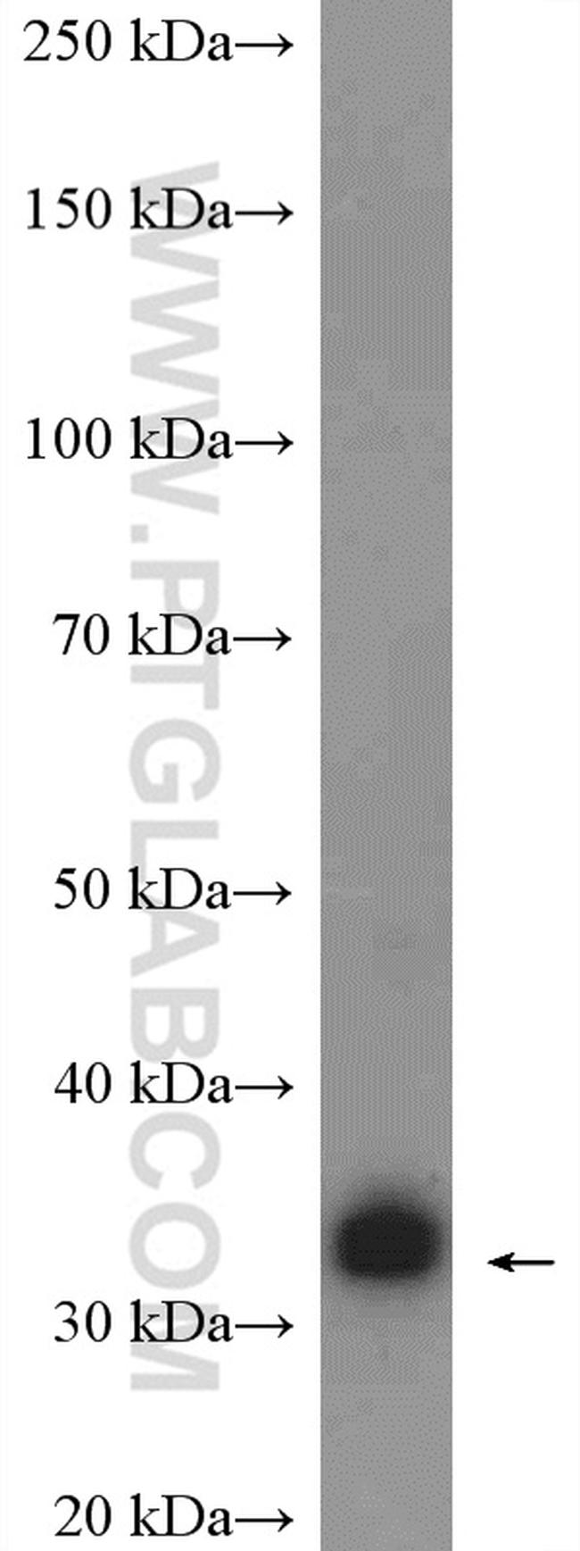 GTF2B Antibody in Western Blot (WB)