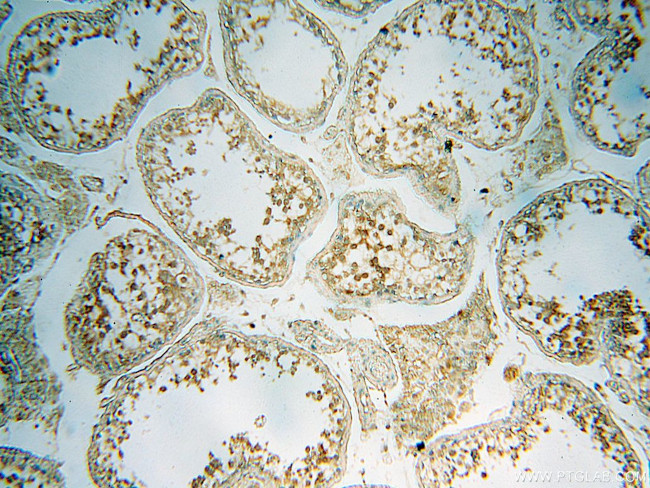 PC6 Antibody in Immunohistochemistry (Paraffin) (IHC (P))