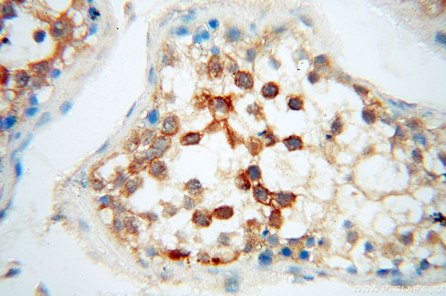 PC6 Antibody in Immunohistochemistry (Paraffin) (IHC (P))