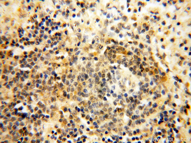 PC6 Antibody in Immunohistochemistry (Paraffin) (IHC (P))