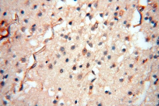 PC6 Antibody in Immunohistochemistry (Paraffin) (IHC (P))