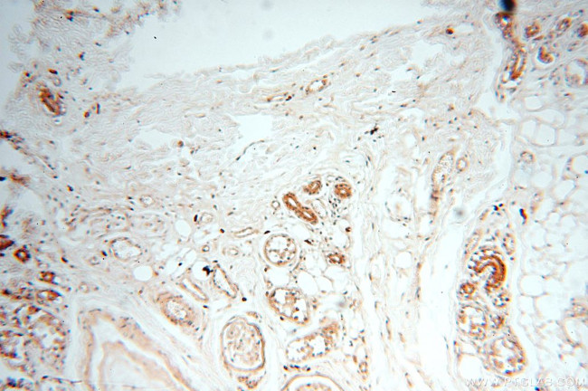 PC6 Antibody in Immunohistochemistry (Paraffin) (IHC (P))