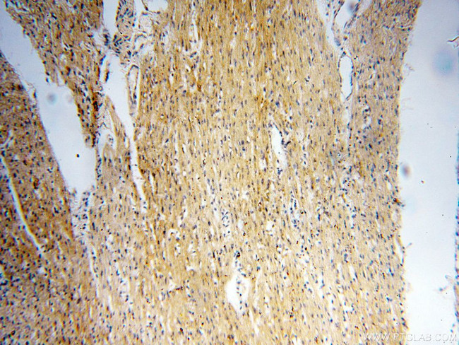 PC6 Antibody in Immunohistochemistry (Paraffin) (IHC (P))