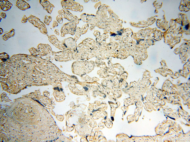 PC6 Antibody in Immunohistochemistry (Paraffin) (IHC (P))