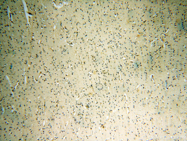 PC6 Antibody in Immunohistochemistry (Paraffin) (IHC (P))