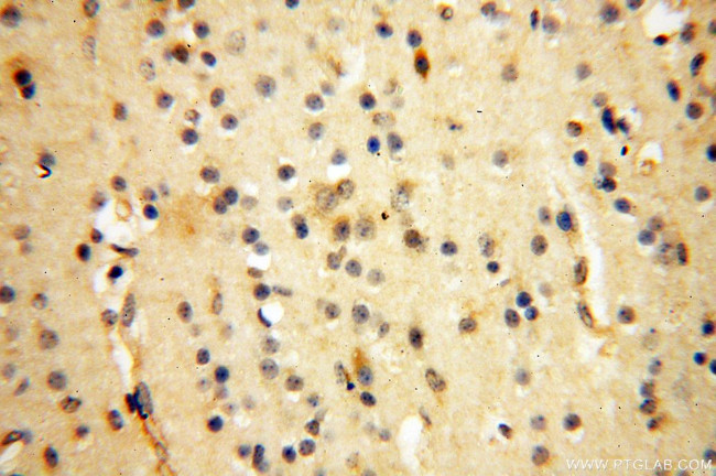 PC6 Antibody in Immunohistochemistry (Paraffin) (IHC (P))