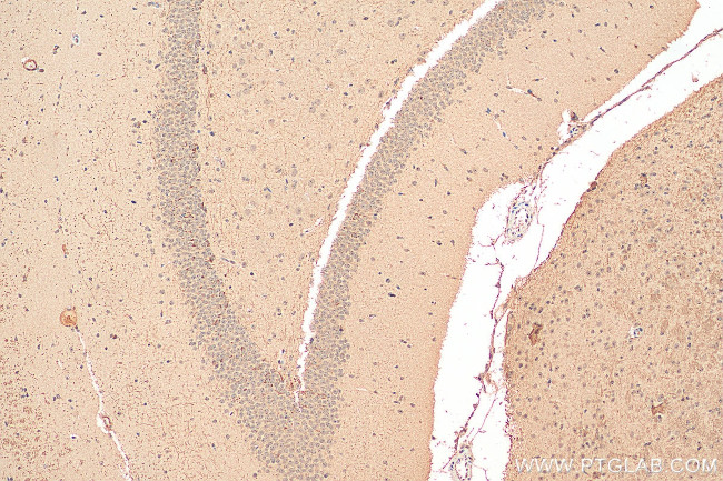 PC6 Antibody in Immunohistochemistry (Paraffin) (IHC (P))