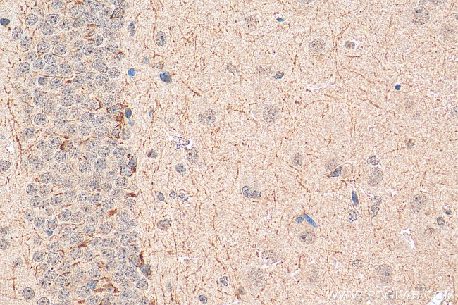 PC6 Antibody in Immunohistochemistry (Paraffin) (IHC (P))