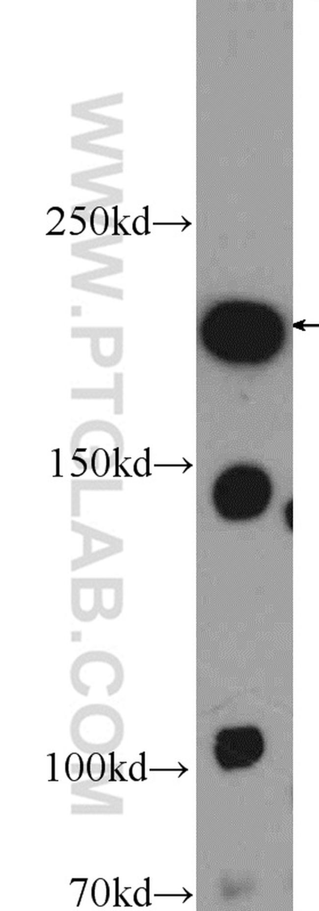 PC6 Antibody in Western Blot (WB)