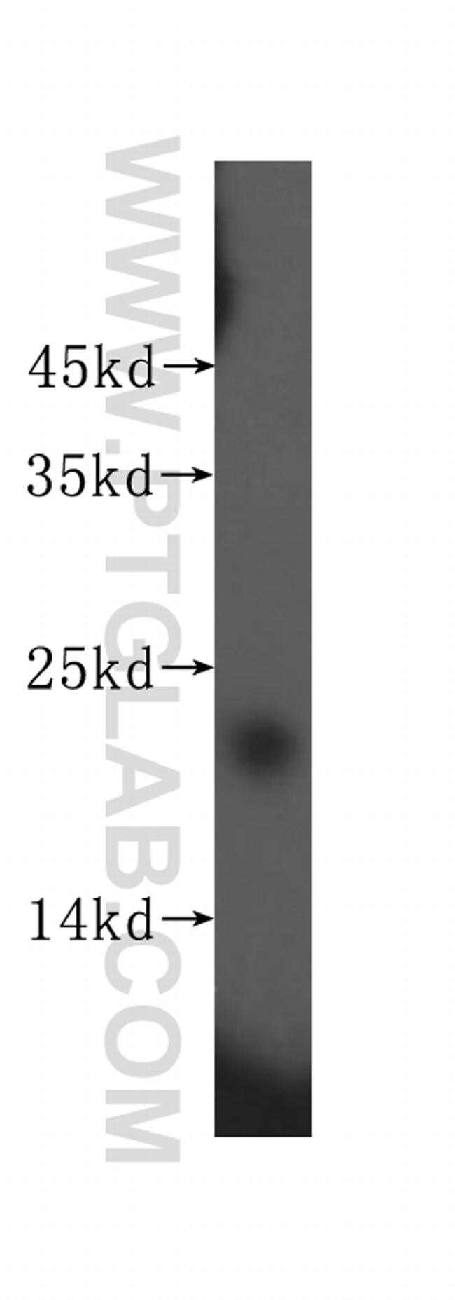 SRI Antibody in Western Blot (WB)