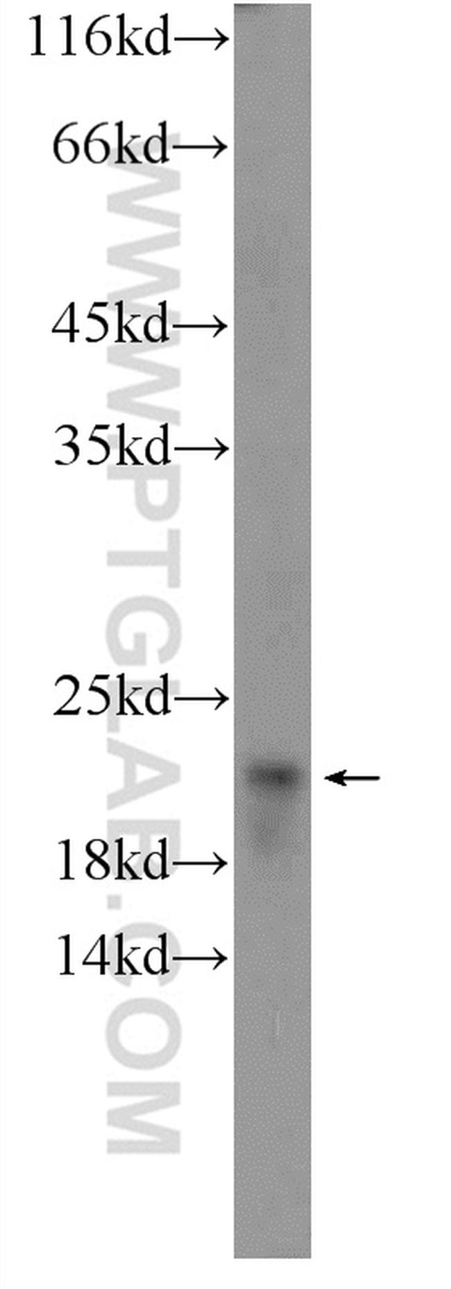 SRI Antibody in Western Blot (WB)