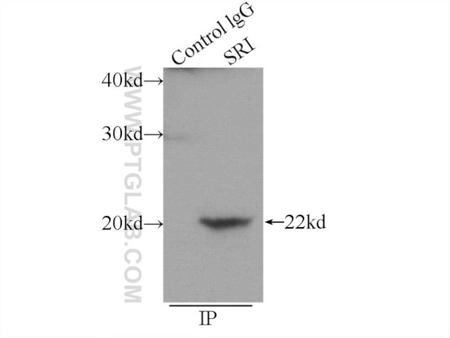 SRI Antibody in Immunoprecipitation (IP)