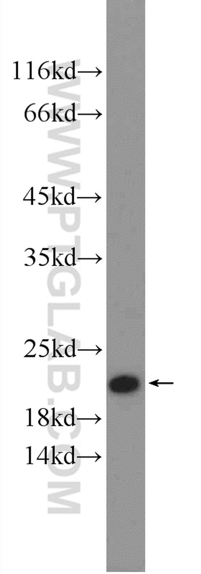 SRI Antibody in Western Blot (WB)