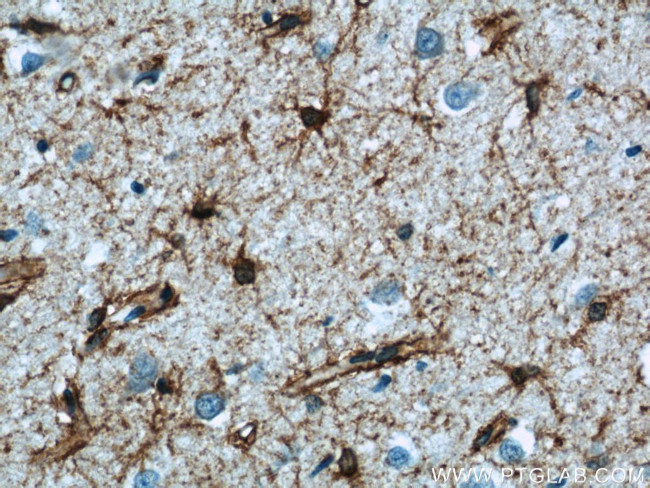 Aquaporin 4 Antibody in Immunohistochemistry (Paraffin) (IHC (P))