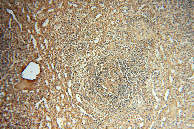 Albumin Antibody in Immunohistochemistry (Paraffin) (IHC (P))