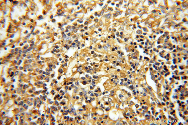 Albumin Antibody in Immunohistochemistry (Paraffin) (IHC (P))