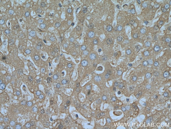 Albumin Antibody in Immunohistochemistry (Paraffin) (IHC (P))