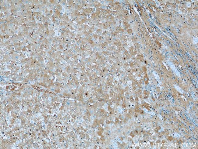 Albumin Antibody in Immunohistochemistry (Paraffin) (IHC (P))