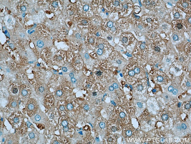 Albumin Antibody in Immunohistochemistry (Paraffin) (IHC (P))