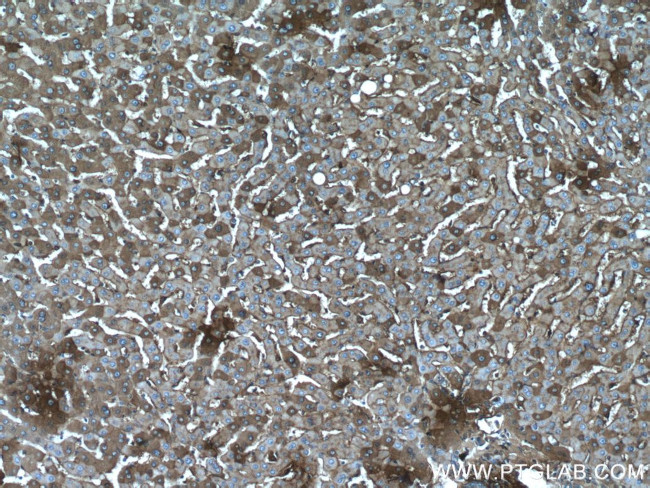 Albumin Antibody in Immunohistochemistry (Paraffin) (IHC (P))