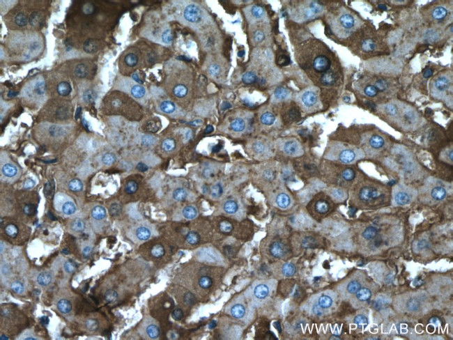 Albumin Antibody in Immunohistochemistry (Paraffin) (IHC (P))