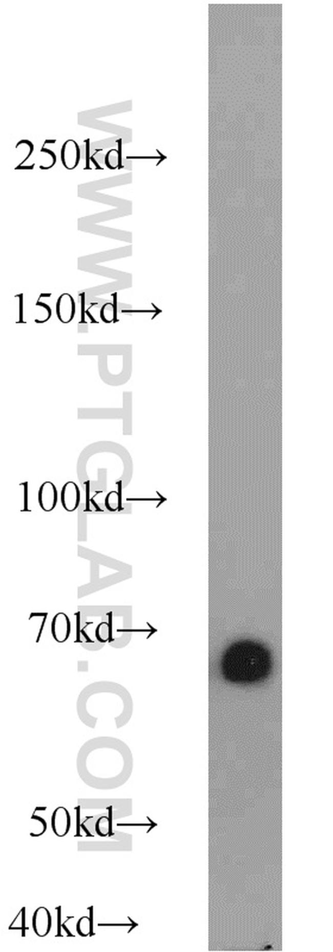 Albumin Antibody in Western Blot (WB)