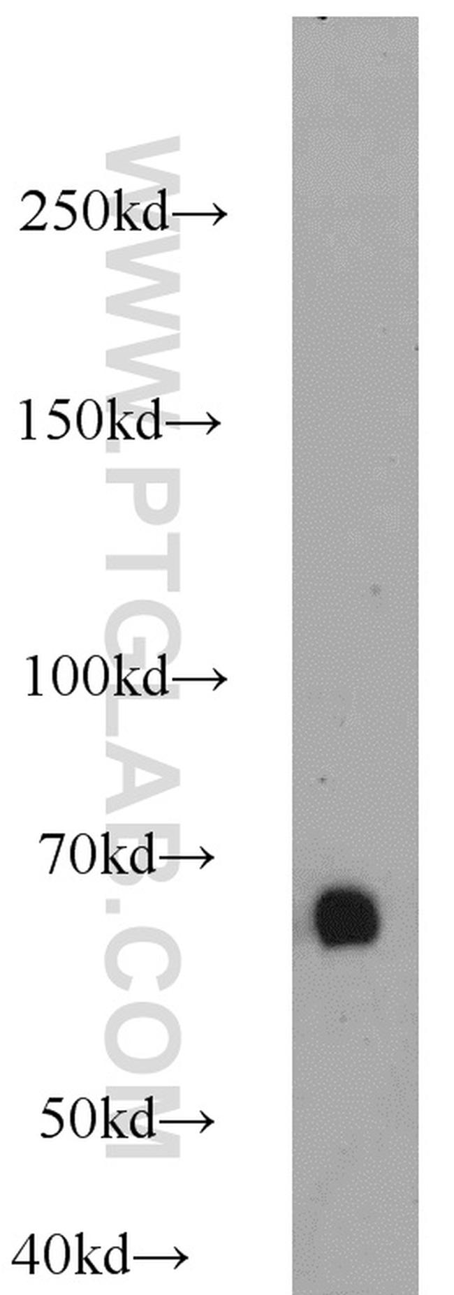 Albumin Antibody in Western Blot (WB)