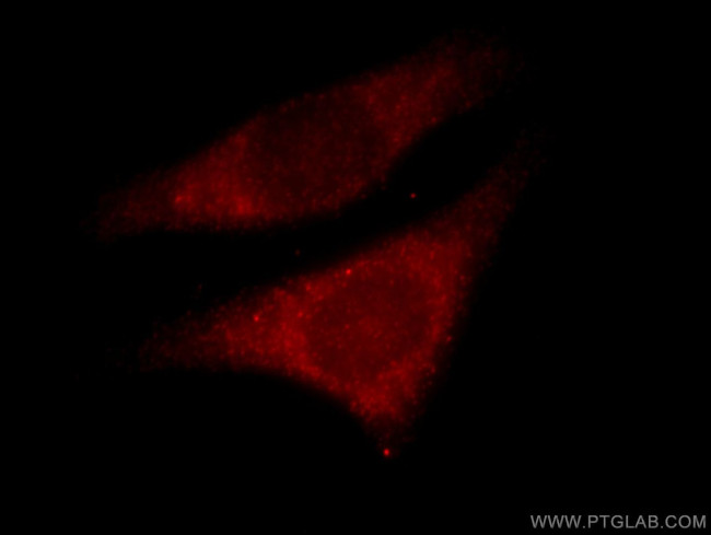 MVP/LRP Antibody in Immunocytochemistry (ICC/IF)