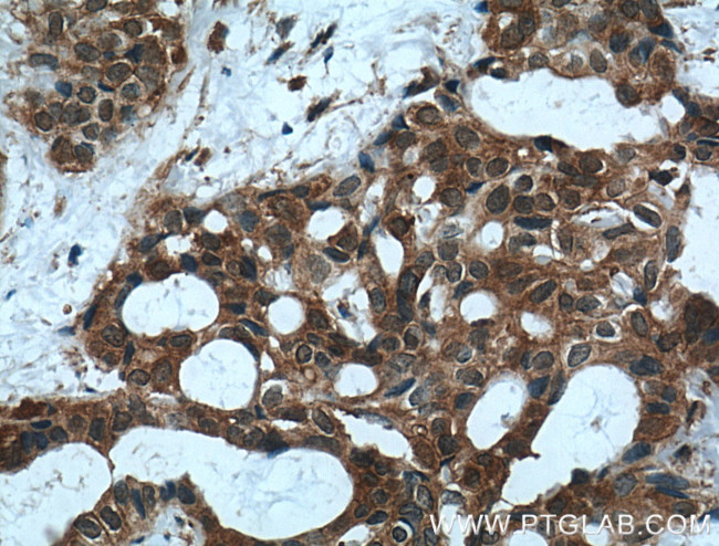 MVP/LRP Antibody in Immunohistochemistry (Paraffin) (IHC (P))