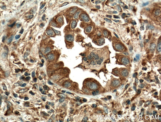 MVP/LRP Antibody in Immunohistochemistry (Paraffin) (IHC (P))