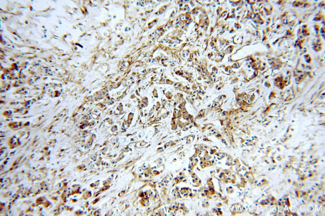 MVP/LRP Antibody in Immunohistochemistry (Paraffin) (IHC (P))