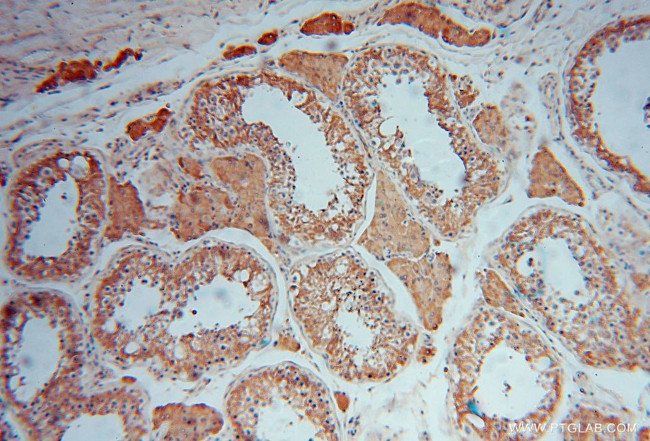 MVP/LRP Antibody in Immunohistochemistry (Paraffin) (IHC (P))