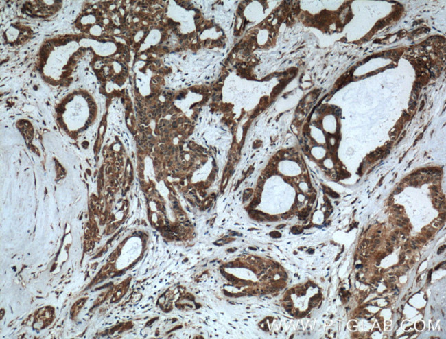 MVP/LRP Antibody in Immunohistochemistry (Paraffin) (IHC (P))