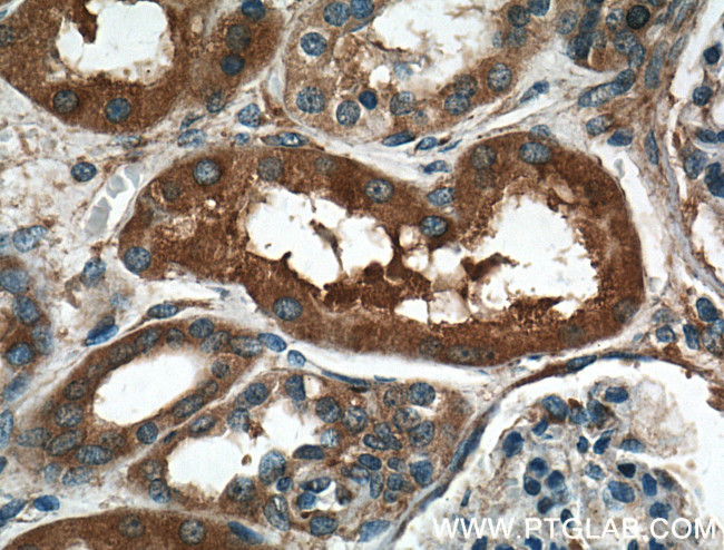 MVP/LRP Antibody in Immunohistochemistry (Paraffin) (IHC (P))