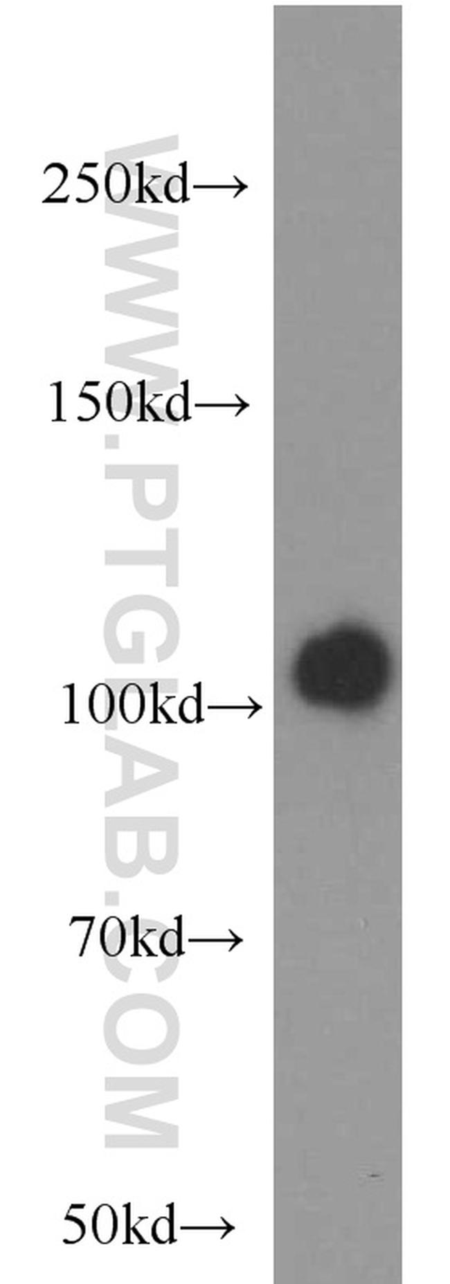 MVP/LRP Antibody in Western Blot (WB)