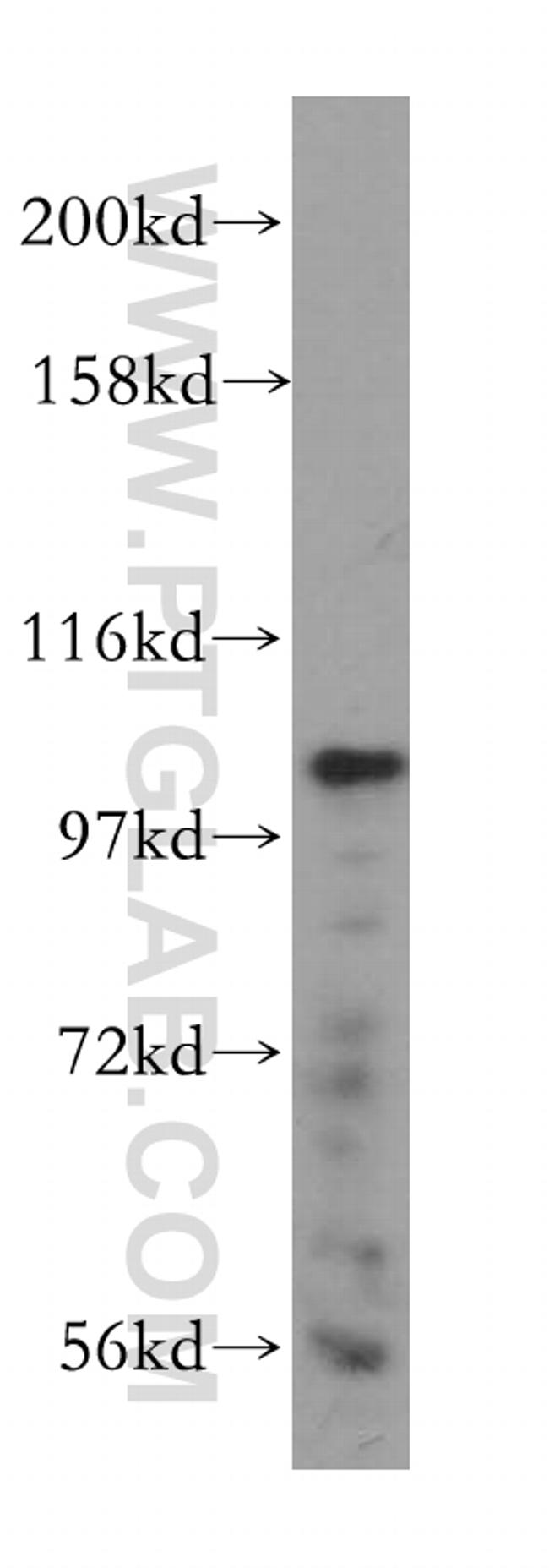 MVP/LRP Antibody in Western Blot (WB)