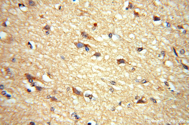 ADO Antibody in Immunohistochemistry (Paraffin) (IHC (P))