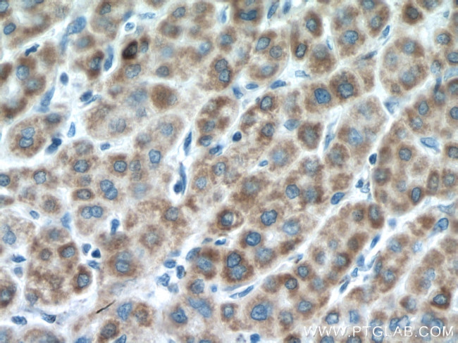 NDUFA4L2 Antibody in Immunohistochemistry (Paraffin) (IHC (P))