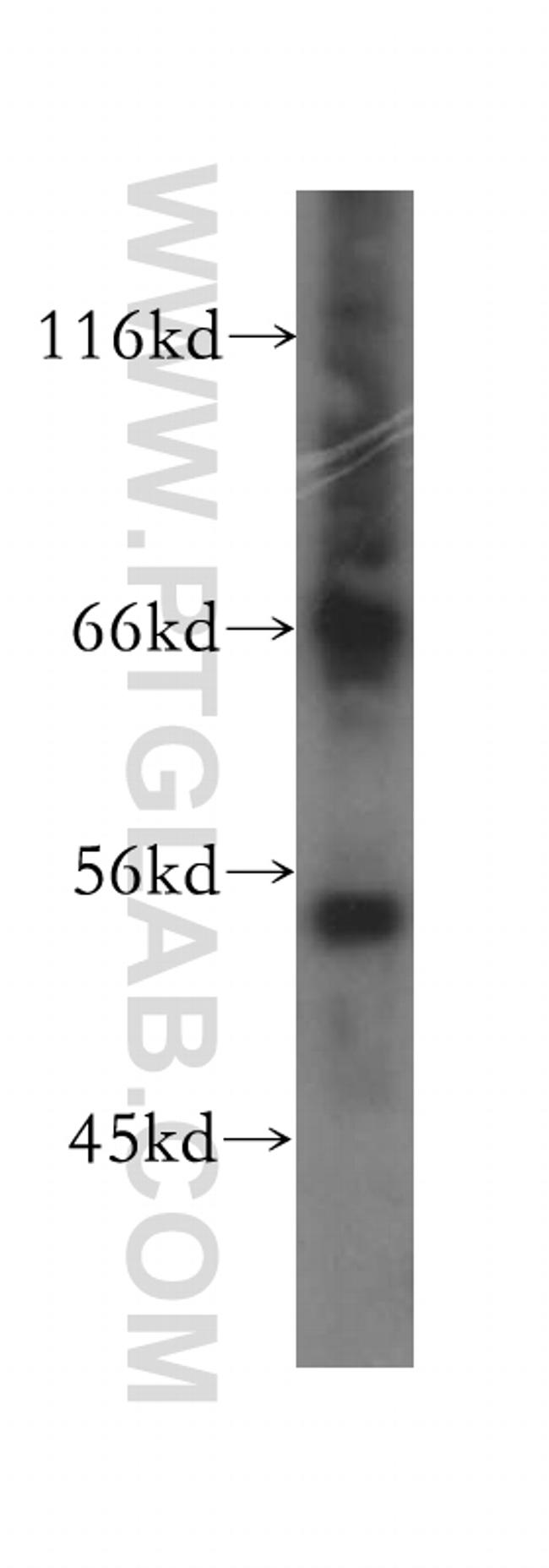 PHAX Antibody in Western Blot (WB)