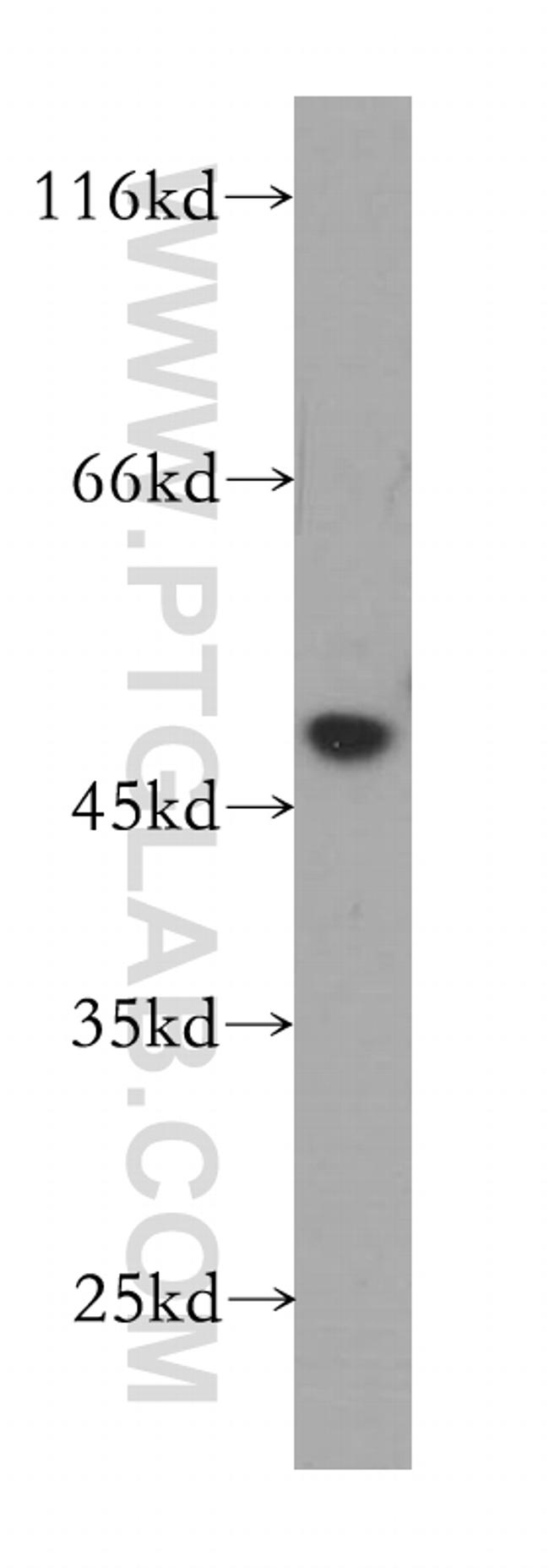 PHAX Antibody in Western Blot (WB)