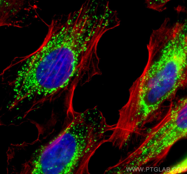 ATP5I Antibody in Immunocytochemistry (ICC/IF)