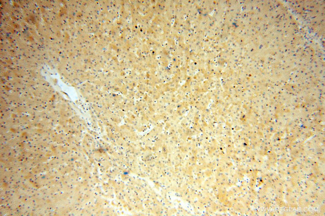 ATP5I Antibody in Immunohistochemistry (Paraffin) (IHC (P))